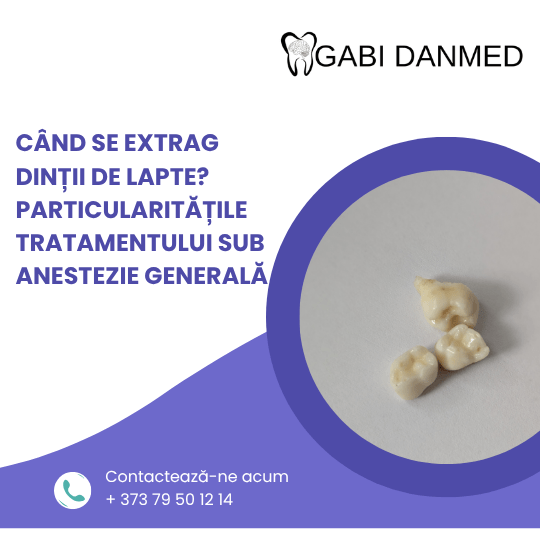 Extracția dinților de lapte la copil în cabinet stomatologic – clinica GABI DANMED Chișinău
